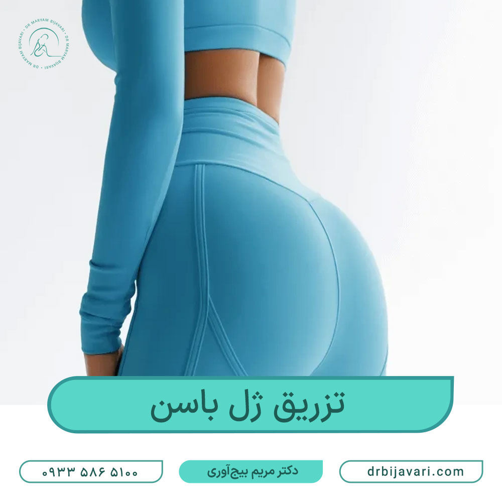 تزریق ژل باسن و هزینه انجام آن در سال ۱۴۰۳